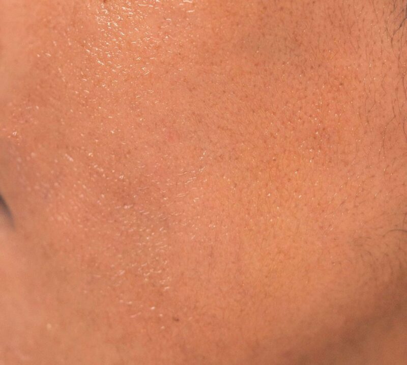 Dewy skin after wearing ORI bakuchiol face balm radiant skin after wearing ORI bakuchiol serum face balm